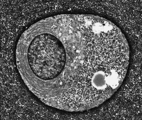 Electron micrograph of a typical articular chondrocyte (Archer & Francis-West, 2003).